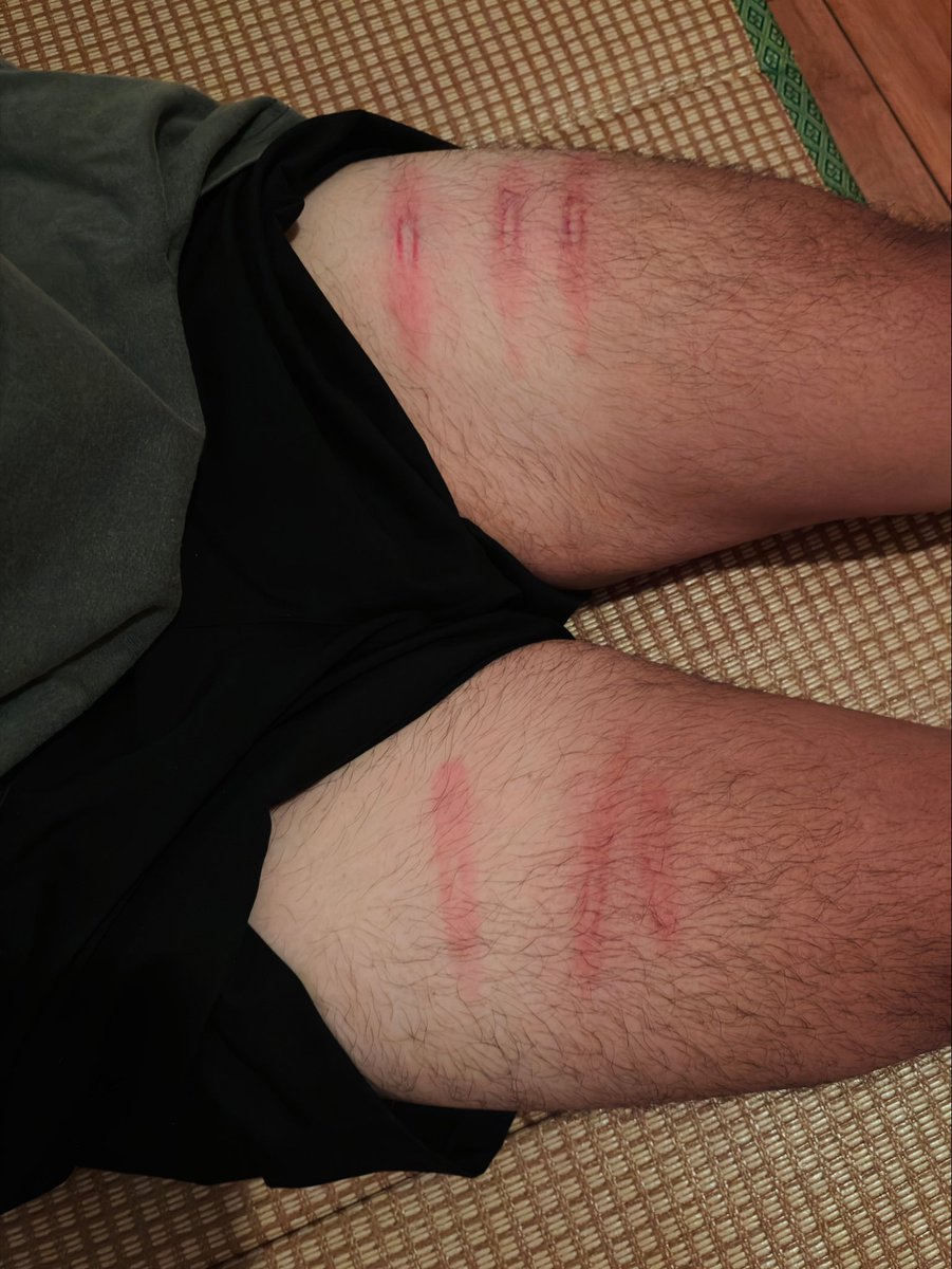happyburger2000's tweet photo. 遇到了一個狠人 大腿已廢

兩個吃很重的被動方互相練習打打，
在經歷了幾次回饋和調整，看到對方滿足的樣子挺有成就感的，覺得開心
但我相信阿梔應該還沒有吃飽～

—20260707在童心園@ageplaybase https://t.co/lZcK0M0O1W
