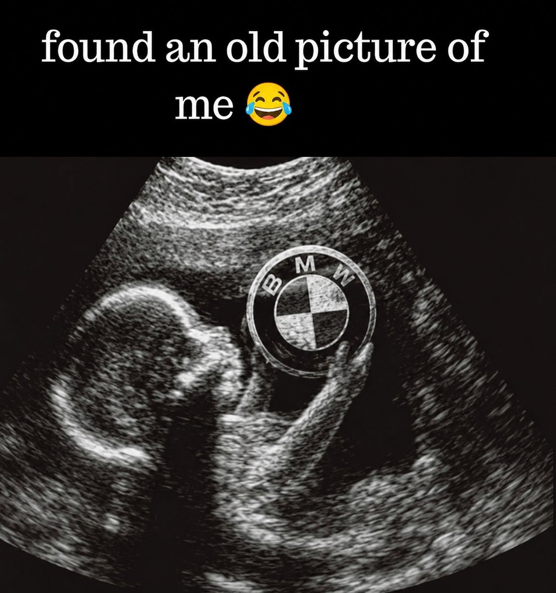 BobbyPetkov_MMM's tweet photo. It's not an obsession...
It's genetics. πππ€
Who else was born with BMW in their DNA? π
#bmw #bmwlife #bmwfans #bmwfamily #petrolhead #carhumour #carmemes #carcommunity #automotive #unclebobby #bobbypetkov #mitmakmotors #staypowerful #fyp #viral #reels #southafrica #bmwlovers #carsofinstagram