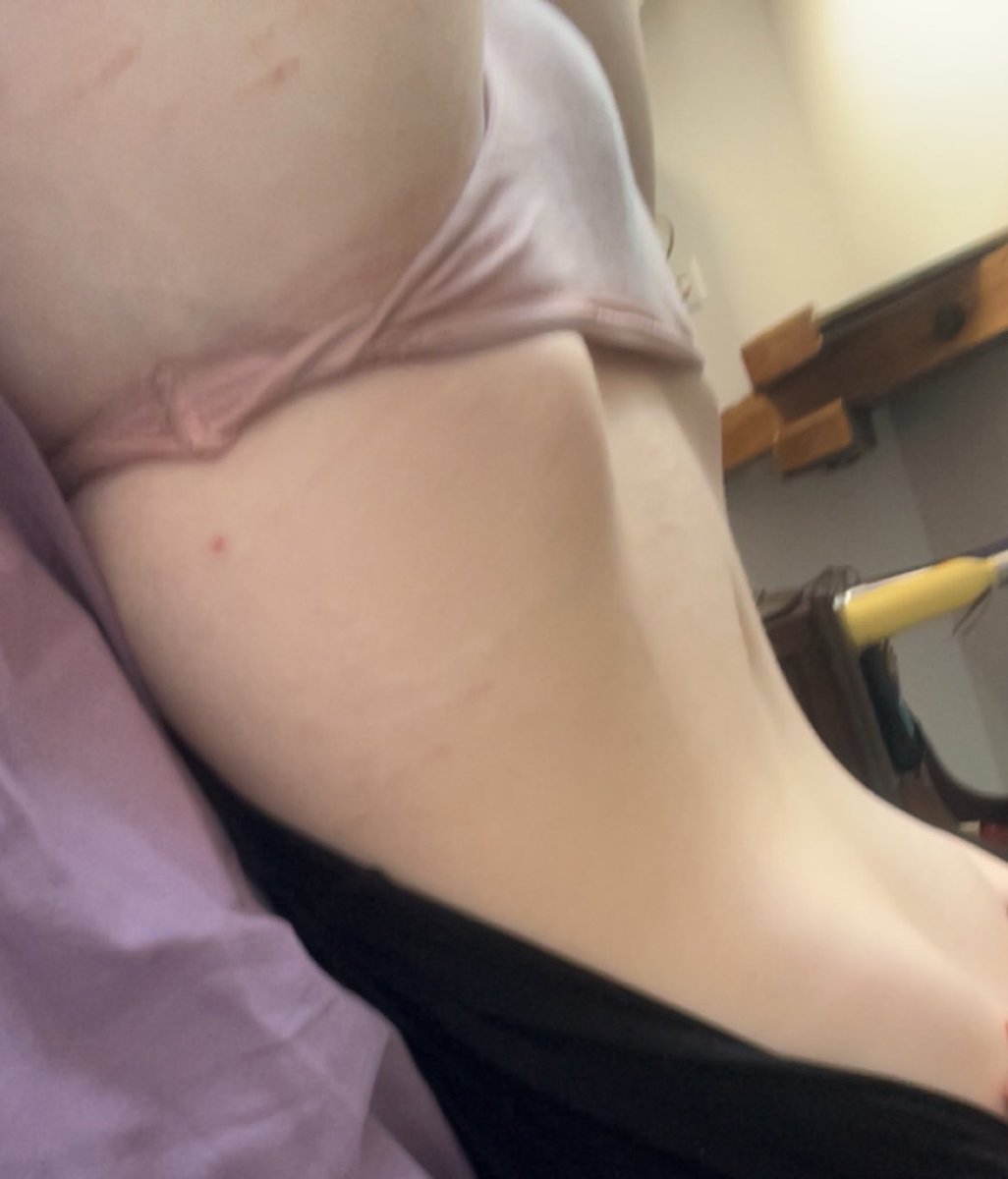 lilybuttiny's tweet photo. Quick body check #edtwt #ed I lost weight !! <3 https://t.co/5x8nHtsfsB