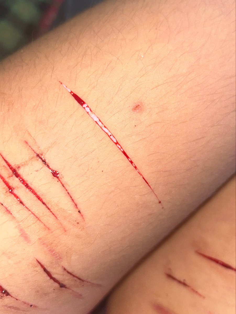 liastrves's tweet photo. Thigh styros 

!! Fake not real !!

#styro #sh #shtwt #shed #shedtwt #syrotwt https://t.co/NyLDcGFhcc