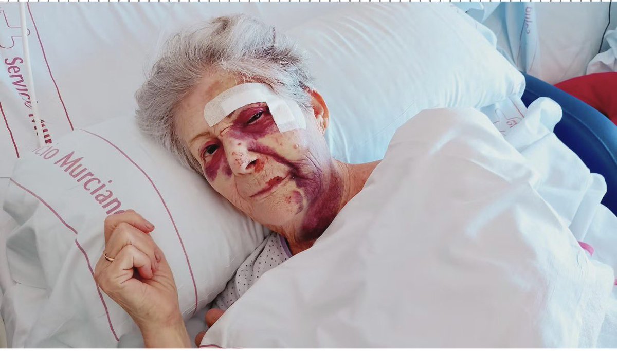davidsantosvlog's tweet photo. Esta señora se llama Ginesa. Un desgraciado de unos 20 años de 1.80 de altura y de origen magrebí (según fuentes del caso) le ha destrozado la cara para robarle el bolso en Santiago de la Ribera, Murcia.

Si alguien tiene información puede contactarme, hay que encontrarlo. https://t.co/mmYSjgsKVa