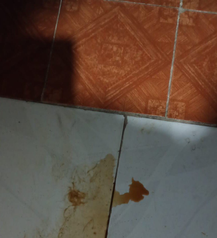 thaiannax's tweet photo. Atualizações da Cacau 😢

Infelizmente, a Cacau piorou. Hoje à noite ela vomitou diversas vezes pelos cantos da casa e, mais uma vez, fez xixi bem escuro. Estamos correndo contra o tempo para conseguir levá-la ao veterinário.

As ajudas praticamente pararam. Não conseguimos arrecadar o suficiente para as vacinas dos 5 cães, não conseguimos comprar o Epi Control, nem o Hemolitan, e agora a Cacau precisa de uma consulta com urgência.

São muitos animais para cuidar e pouca ajuda. Estou fazendo tudo o que posso, mas sozinha não estou conseguindo.

Qualquer valor pode fazer a diferença.

Pix (CPF): 149.983.397-02

Se não puder ajudar financeiramente, por favor, compartilhe esta publicação. Talvez ela chegue até alguém que possa ajudar a salvar a Cacau. Por favor gente ..