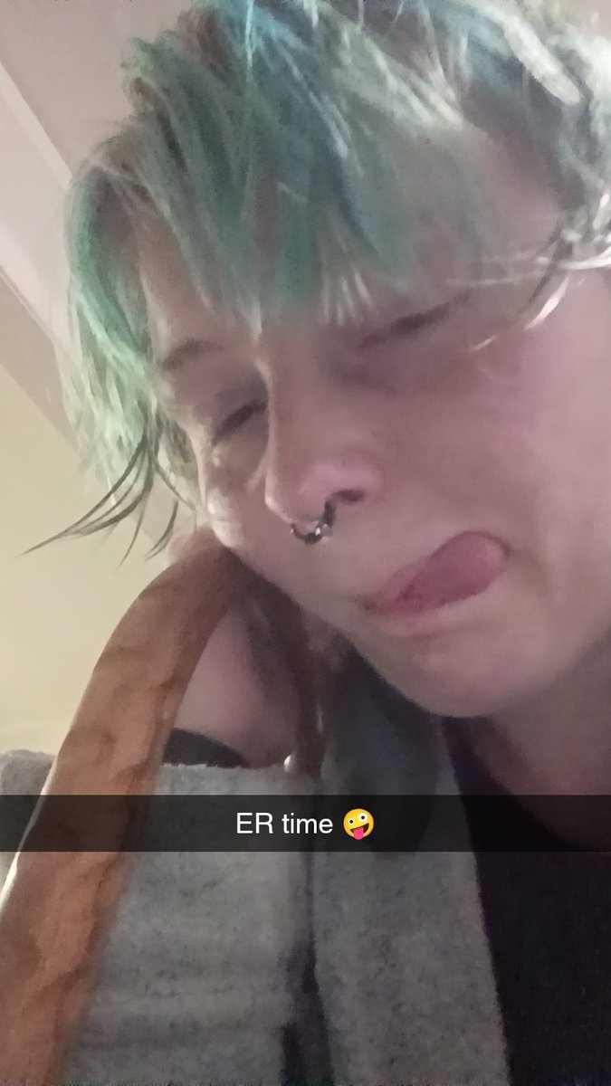Little_N00dle_'s tweet photo. Guys. I have sprained my ankle and can barely walk, have a surgery on Thursday so I can't even take anti inflammatories, I'm on my period and I'm covered in scrapes I had to call out of work today, and I'm lowkey drowning in constantly increasing medical debt. Kill me now 🙏 https://t.co/NAuYRmVpOe