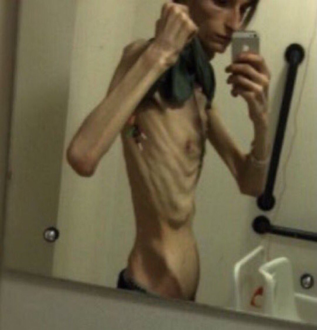 RecluseOfShedtw's tweet photo. Edtwt and shedtwt, does anybody else look and thinspos and just have them like, not work? Only deathspo has ever "worked" for me because I genuinely want to look like that, not the normal thinspo stuff, for example, this https://t.co/DeaznIFuT3