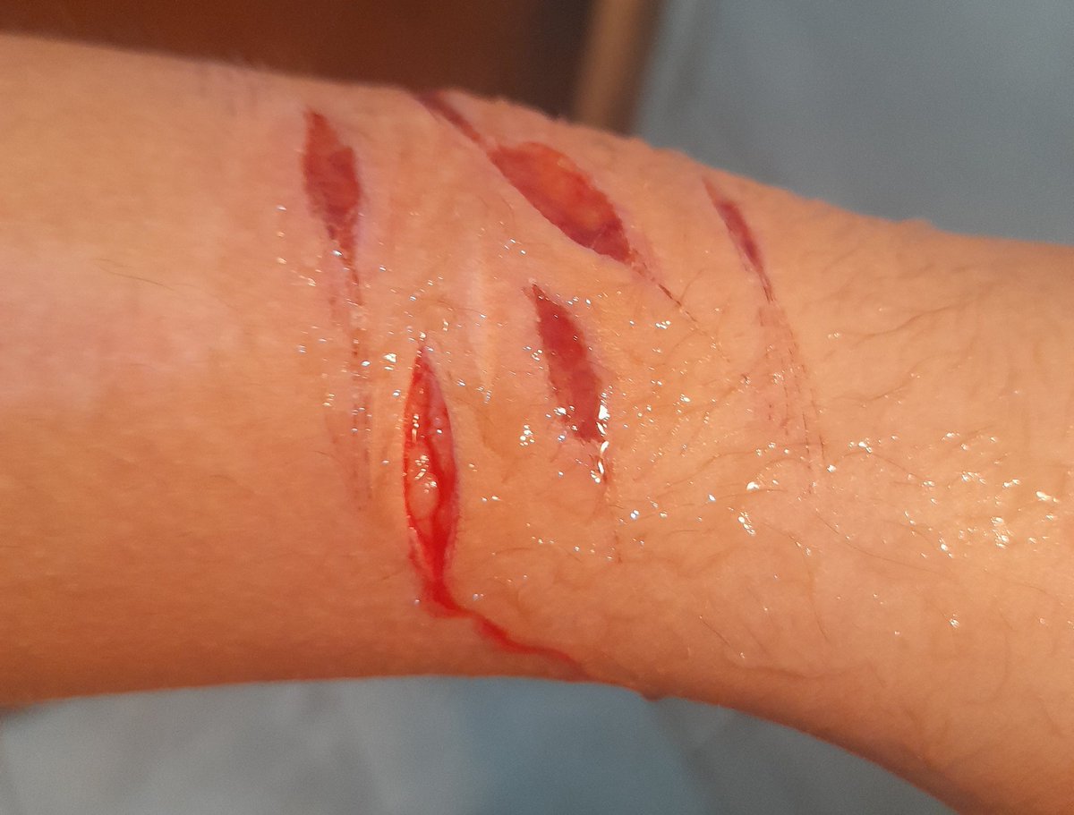 bestedenever's tweet photo. #shtwt #selfharm https://t.co/E7lve37Jh1