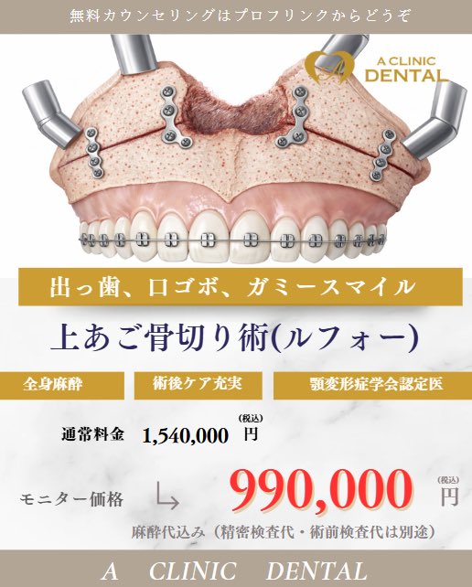 6zKVomo3Yf92819's tweet photo. 【7〜9月の骨切りキャンペーン】
全身麻酔代込みで添付図の料金で骨切りを行わせていただきます。無料カウンセリング実施中。
#骨切り #両顎手術　#受け口 #出っ歯　#ガマースマイル　#口ゴボ #小顔になりたい　#ルフォー　#SSRO https://t.co/YoaZERXcl6