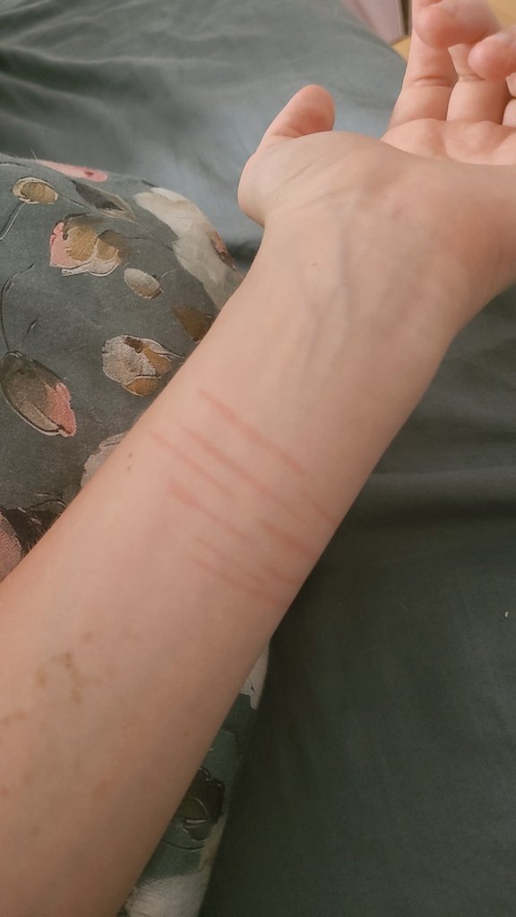 Marsh_mellowzz's tweet photo. Its almost 8AM i hat NO SLEEP and i got a heart attack of my own arm because i thought i relapsed this night and didnt remember it omfg, i completely forgot that i drew that with gel pens while drawing a few hours ago💔💔💔 https://t.co/sBB3vMdU4P