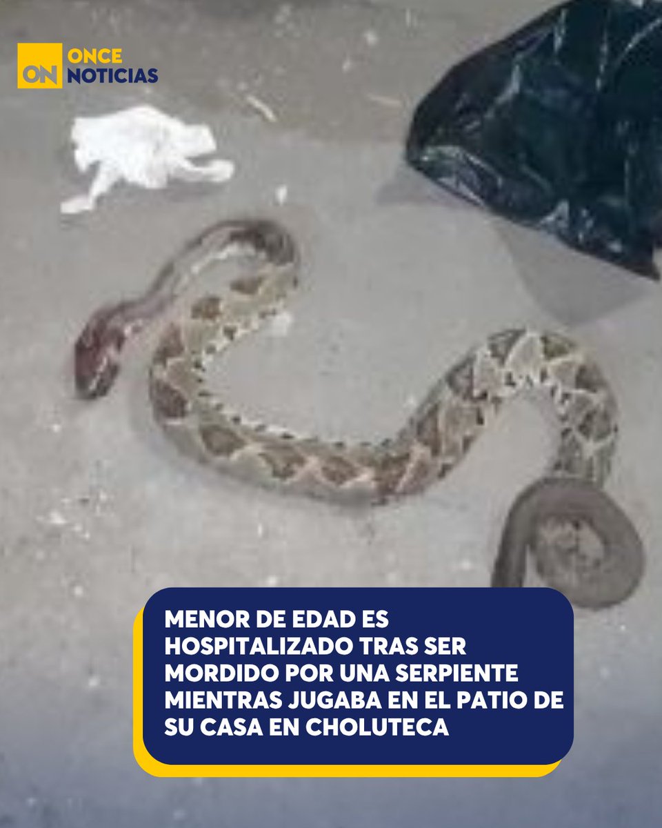 canal11hn's tweet photo. 🐍🚨 Un niño fue hospitalizado tras ser mordido por una serpiente mientras jugaba en el patio de su casa en Choluteca. Conozca cómo ocurrió el incidente, su estado de salud y las recomendaciones de las autoridades. 👇
https://t.co/KDeqdHjfSS
#Niño #Mordedura #Serpiente #Choluteca #SanMarcos #Honduras