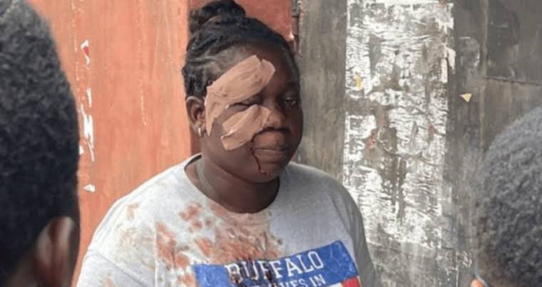 asemota's tweet photo. Something flipped here after the 2023 results for the Nigerian Presidential elections in Lagos state were revealed. The APC financial base was threatened and people came out to start beating people trying to vote in the gubernatorial election. It has not been the same since then. https://t.co/z6rZatu1LC