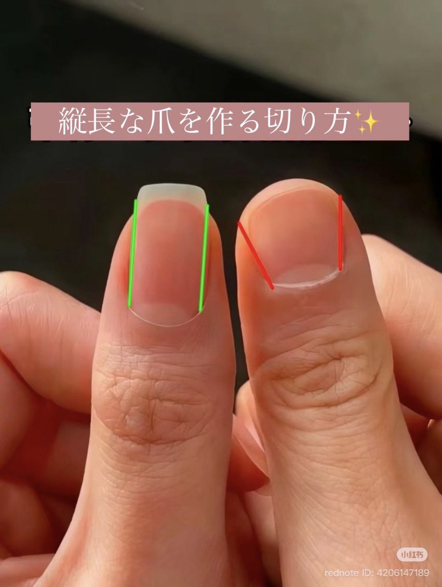 yuna_skincare77's tweet photo. どこかで見つけた縦爪に伸ばす爪の切り方、ネイルしてなくても褒められるし自爪でする子は綺麗にできる👇 https://t.co/l8Q8enLyKa