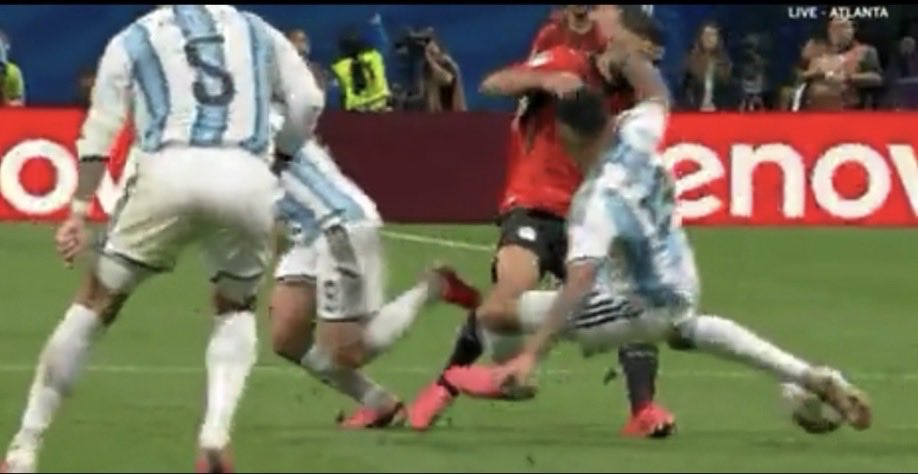 KloppsBumCheeks's tweet photo. @Those101Things @kushagrakashyap @WorldCup26HQ Your actually fucking stupid 🤣🤣🤣🤣🤣

Follow through with the second.

Intent to injure its a red day and night in any top 5 leagues.

Romero has been sent off in the prem for less 🤣🤣🤣 https://t.co/xAfefi84G6