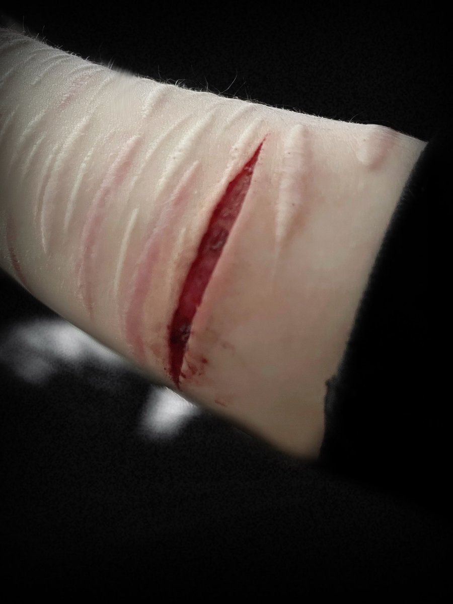 itriedallalong's tweet photo. oddly a favorite photo of my new cut i did on my right wrist a few hours ago, it was deep styro and had some bb beans!
⦻ FAKE SFX MAKEUP!
#SELFHARMTRIGGERWARNING
#sh #shhtwt #selfharm
#slittwt #shed #shedtwt #988shtwt #beans #babybeans #scarspo #988twt https://t.co/jd2FjUNYyq