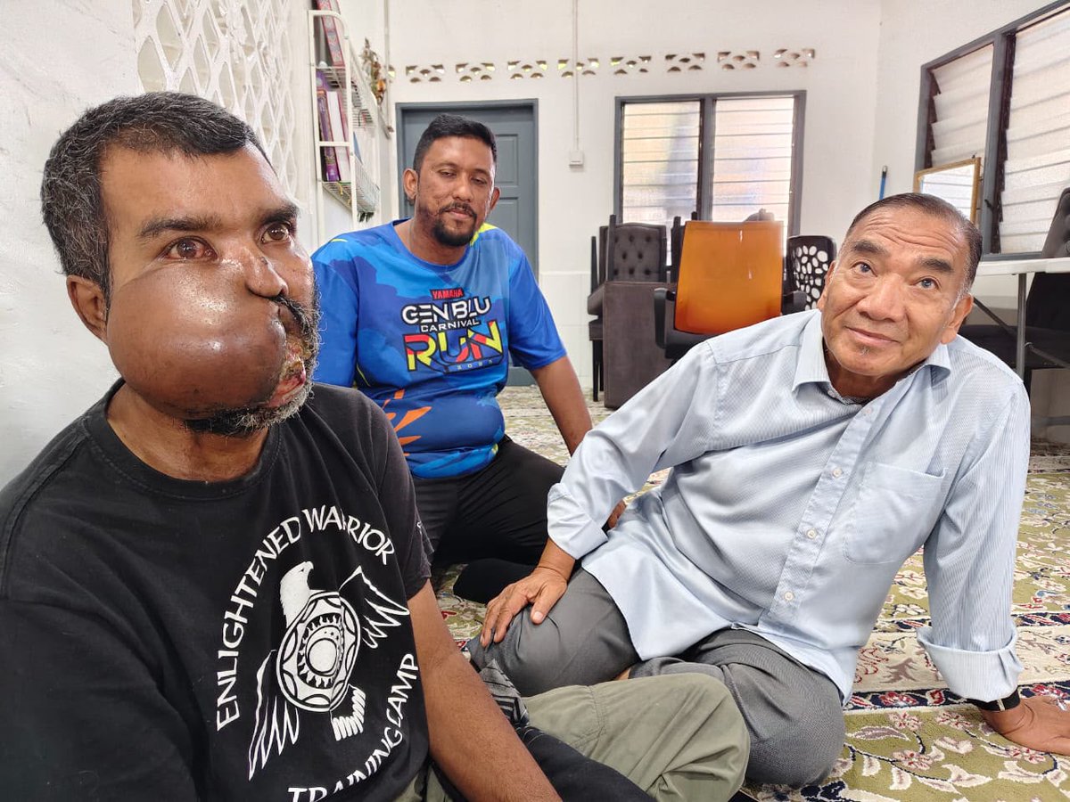 SinarOnline's tweet photo. 'Saya mahu sembuh' - Penggali kubur derita kanser mulut rayu bantuan

"Saya dah tak boleh buka mulut untuk makan. Setiap hari saya hanya minum guna tiub kerana itu sahaja cara untuk saya dapatkan tenaga."

BACA: https://t.co/i1XVqoA6yI

#sinarharian #beritaterkini #kanser https://t.co/41cvNqgMYx