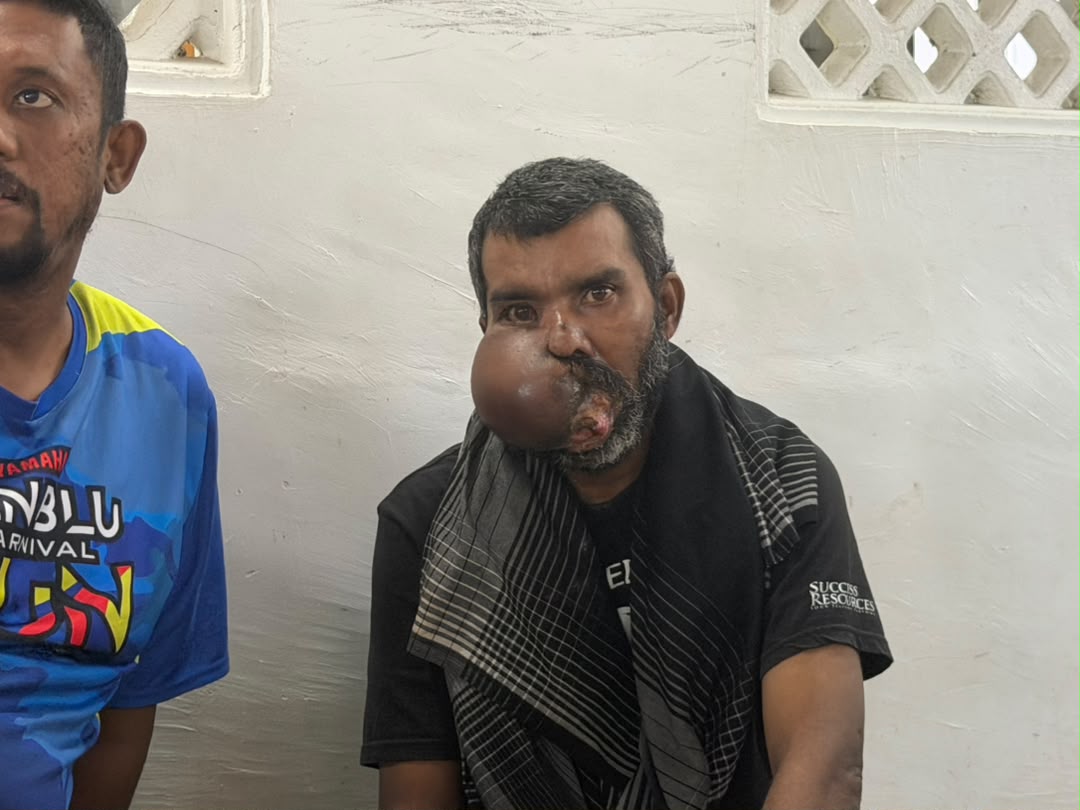 SinarOnline's tweet photo. 'Saya mahu sembuh' - Penggali kubur derita kanser mulut rayu bantuan

"Saya dah tak boleh buka mulut untuk makan. Setiap hari saya hanya minum guna tiub kerana itu sahaja cara untuk saya dapatkan tenaga."

BACA: https://t.co/i1XVqoA6yI

#sinarharian #beritaterkini #kanser https://t.co/41cvNqgMYx
