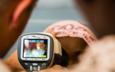 MRC_Uganda's tweet photo. The eye could hold the key to detecting diseases long before symptoms appear.

We're proud to be part of the new Africa Oculomics Research Programme that is using AI and retinal imaging to explore earlier detection of cardiovascular, kidney and neurological diseases in African populations.

Read more: https://t.co/PaeCEAoZ0P