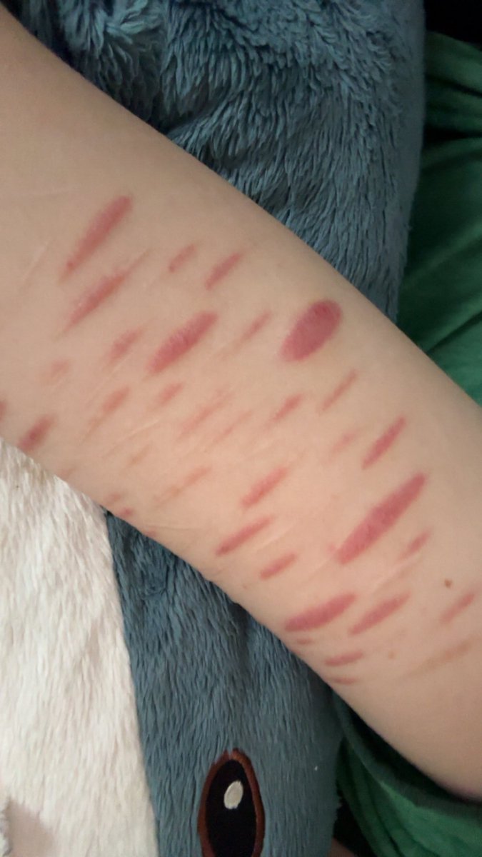 d0IIfac3's tweet photo. My friends reaction to my scars???? Thanks??? https://t.co/INgalwdIVK
