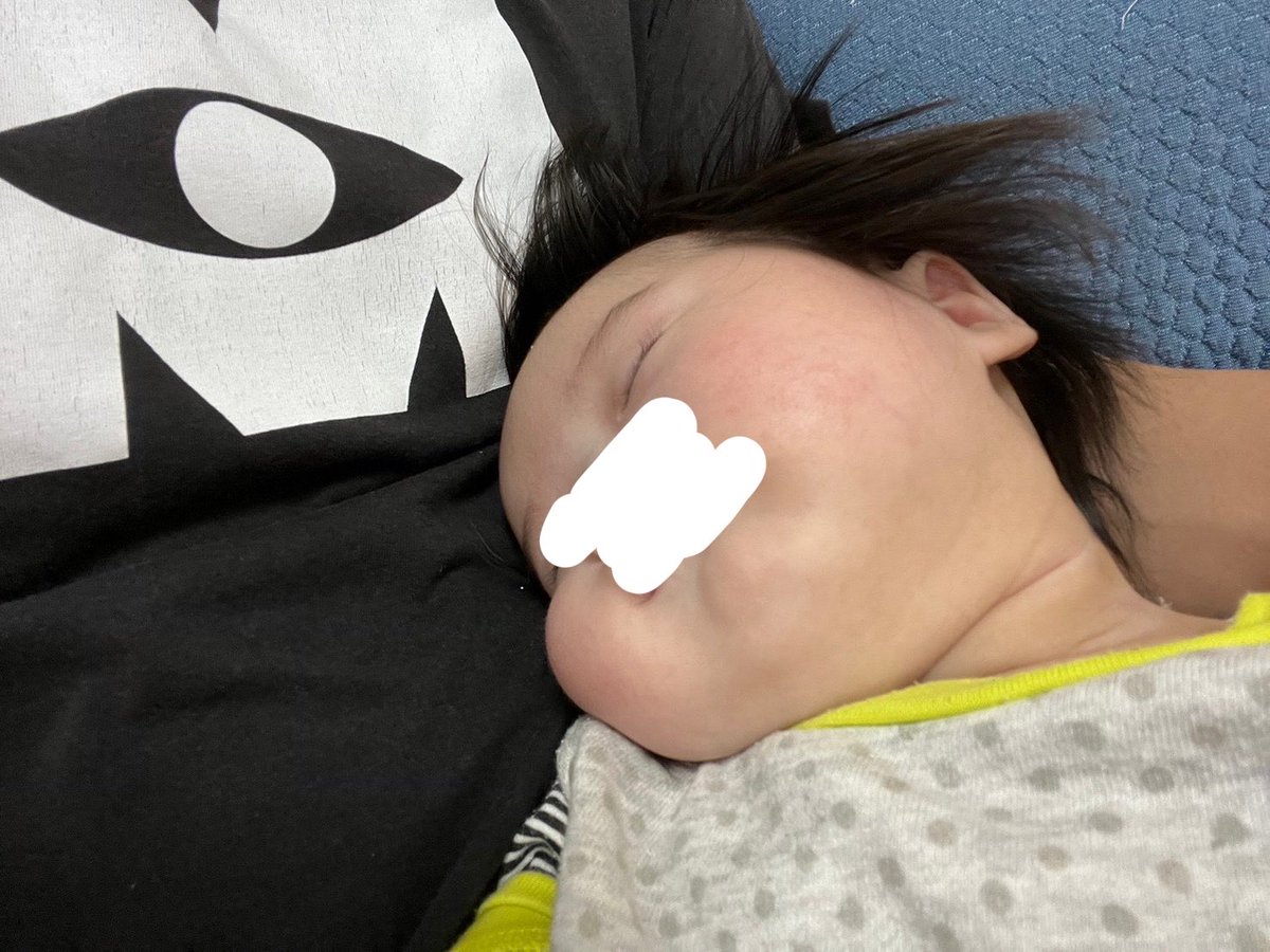 DAC8_2525's tweet photo. クソ生意気なガキンチョに育った息子にもこんな時期あったな…
ほっぺたどないなっとんねん https://t.co/ge6bpqszGF