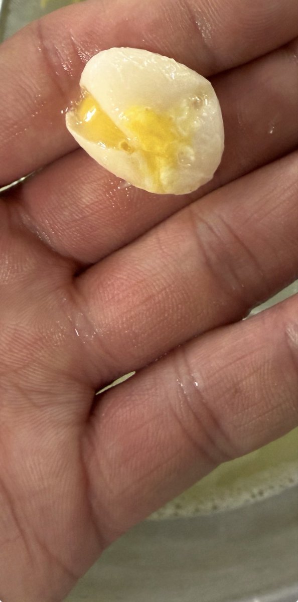 tomchaang's tweet photo. 卵を割ったらその中に小さな殻付きの卵が😳😳😳
調べたら20万個に1個位の割合であるみたい😆 https://t.co/mPIBHo6OWR