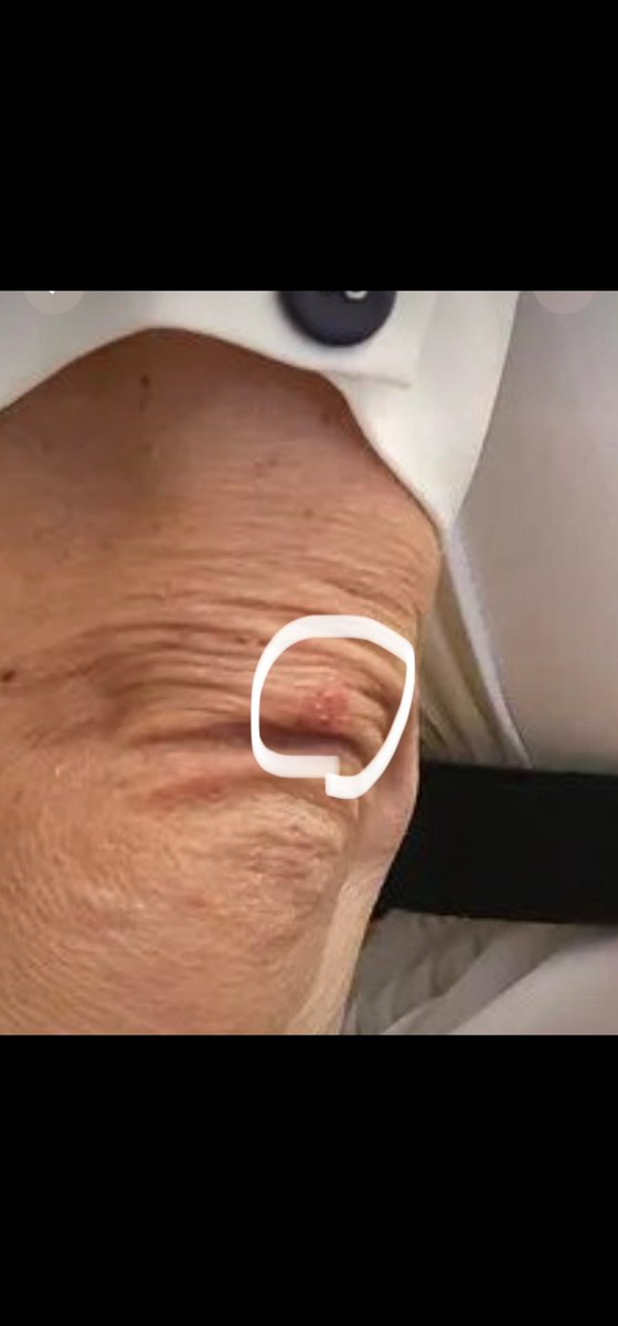 susanmaclean41's tweet photo. #Clicks using your dying mother! Wow!  Typical supporters of #FancerKate, as the world knows her to be! Lay with dogs #Kitty, and the fleas will bite! Infact, they already have... #Khate taking the infection to a children's critcal care hospital ward! 😬🙄🤯🥹 https://t.co/mJOEJzFQMl