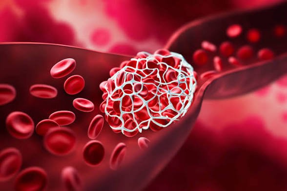 Sainte_Hermine5's tweet photo. Un simple caillot de sang peut basculer une vie en quelques secondes : AVC, infarctus, thrombose.

Pourtant, la nature nous a donné des armes pour fluidifier notre sang et protéger nos artères.

Voici 7 aliments naturels redoutables à intégrer d'urgence dans votre quotidien. 🧵 https://t.co/t7b4hZHw6D