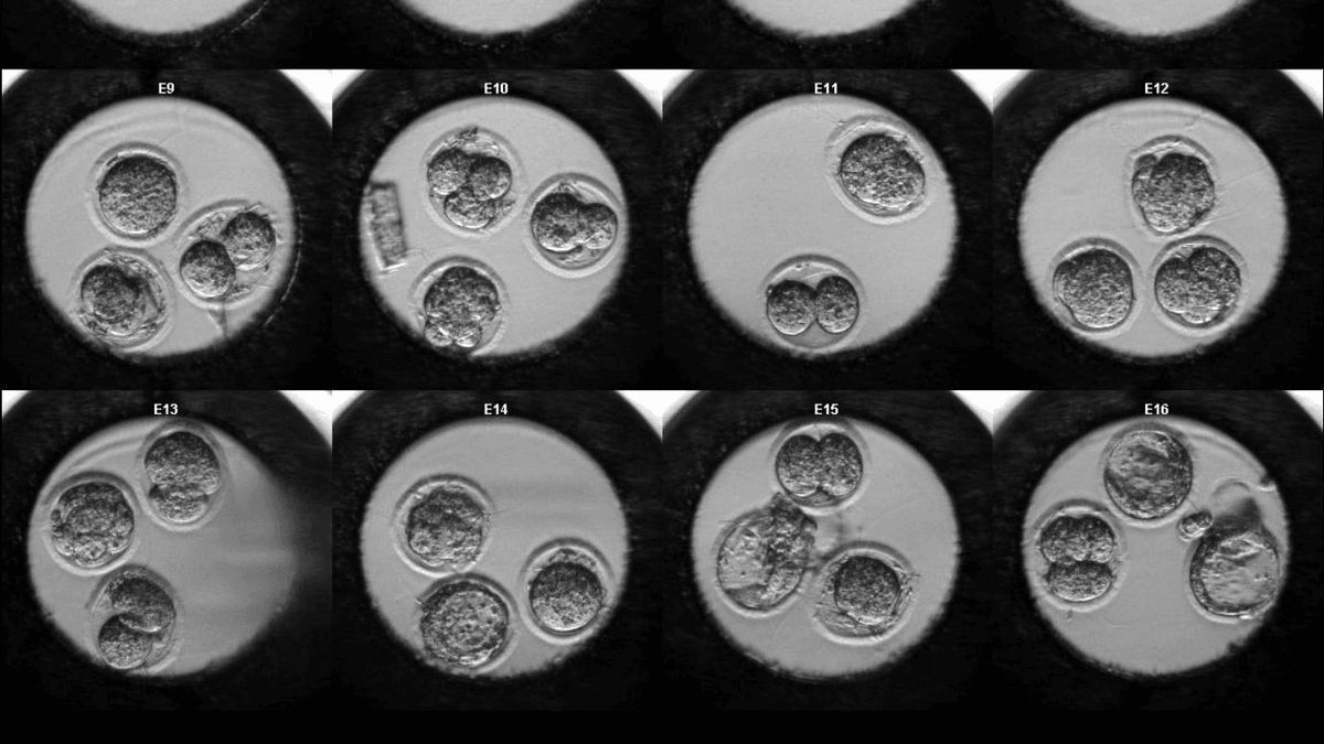 FulkaLab's tweet photo. Reminder: A normal chromosome count ≠ a successful pregnancy.
In our aged mouse model:
🧬 50% of oocytes were euploid
🧫 25% hit blastocyst stage
🛑 0% resulted in live births

Euploidy is just the baseline. The rest matters just as much.
https://t.co/RPpzgmRKK6
#Oocyte #Aging https://t.co/DcyxGZX77j