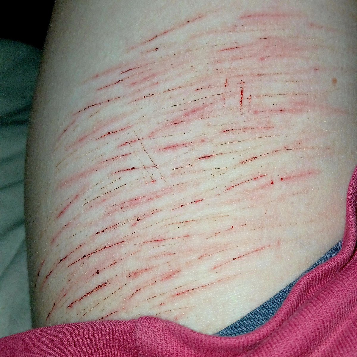 S1lly4ntMoth's tweet photo. @velvetbunnydoll Those are definitely styros, cat scratches look like this !!

(Alsso cutspo🥹) https://t.co/jnMwPiNcC1