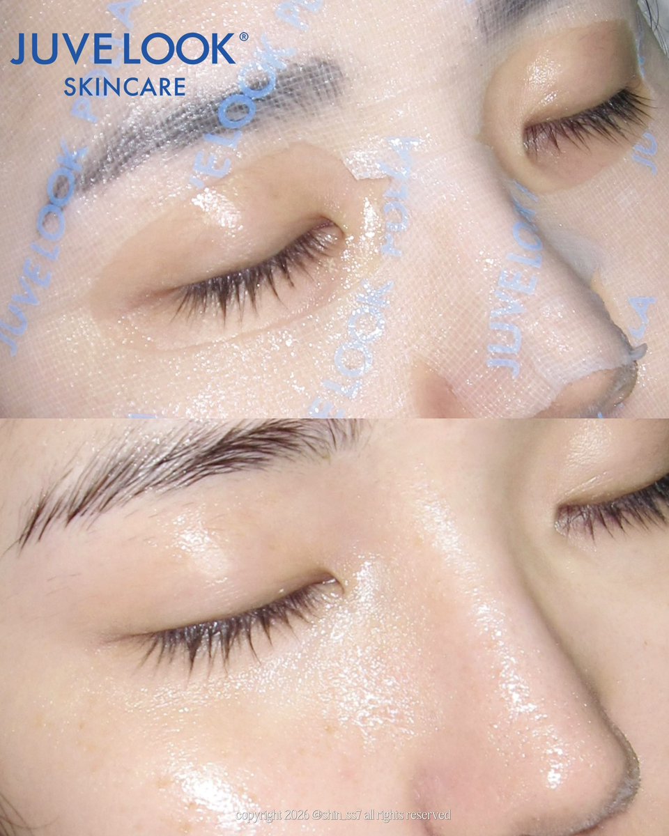 shin_ss7's tweet photo. [광고] #RT이벤트
#RT + @juvelook_skin 공식계정 팔로우
해주신 3분께 “쥬베룩 PDLLA 콜라겐 부스팅 마스크”을 증정해 드려요🎁

쥬베룩 스킨케어의 독자성분인 JUVELOOK PDLLA™을 담아
탄력 케어를 넘어 피부 속 콜라겐 생성 환경까지 고려한 마스크팩 ❗️

요즘 스킨케어에 신경을 못 써주고 있어서 피부가 어딘가 모르게 푸석하고 음울해보였는데, 마스크팩 한 장했다고 한 번에 촉촉쫀탱한 피부가 완성이 됨…✨

피부 속 깊이 수분을 꽉! 채워주는데도, 겉에 수분감이 남아돌아서 속건조 심한 분께도 안성맞춤인 마스크팩..!

이거 당장 효과도 좋지만, 찐은 다음 날이라는 거… 타래로⬇️