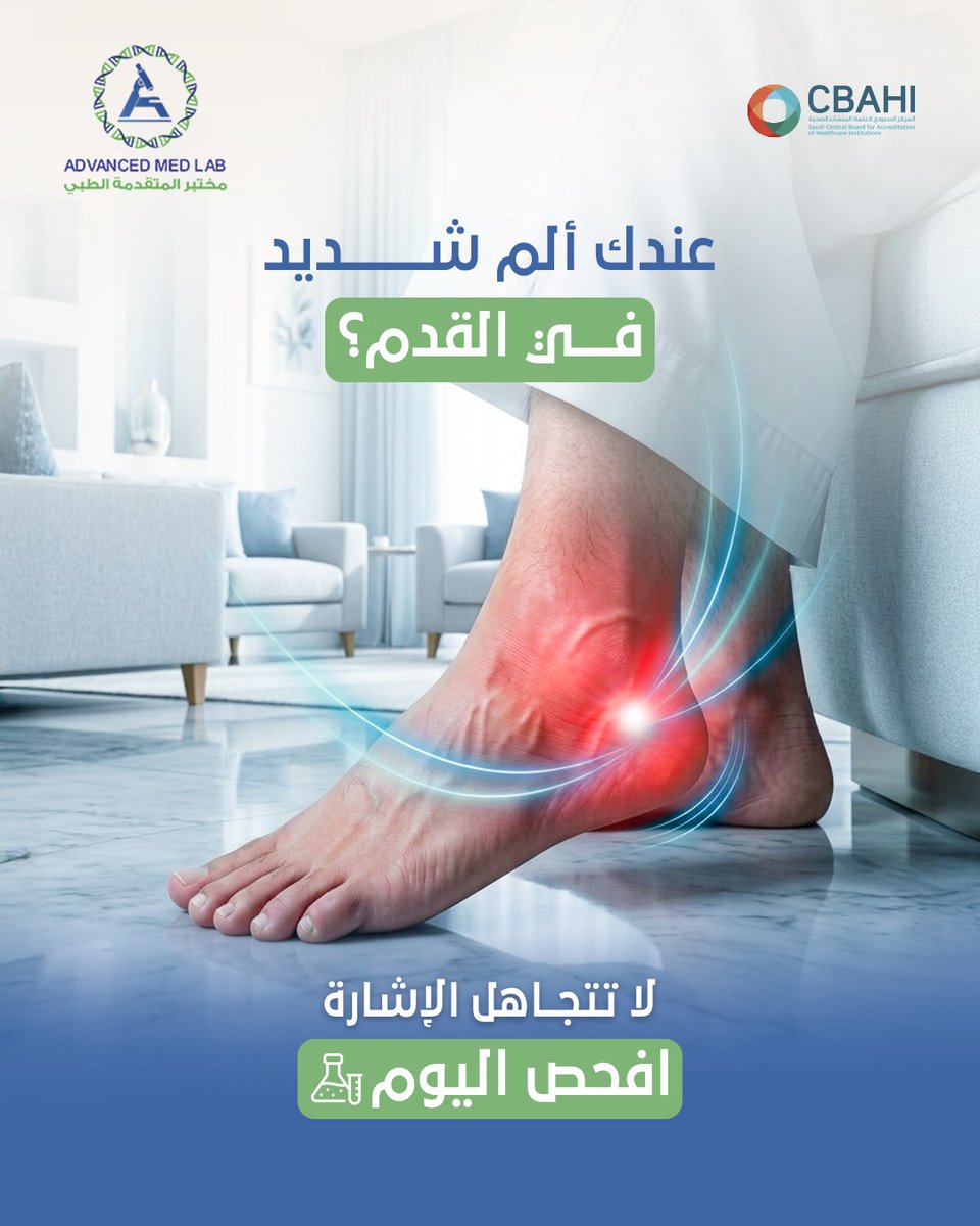 advanced_medlab's tweet photo. ارتفاع اليوريك أسيد صامت...حتى يظهر أول ألم في القدم.

ارتفاع حمض اليوريك يمر دون أعراض في فترة الأولى،وبعد ذلك في بعض الحالات يؤدي إلى نوبات مؤلمة من التهاب المفاصل وألم القدم عند المشي أو الإتكاء عليها لفترة طويلة

اطمئن على صحتك..واحجز فحصك اليوم.
للاستفسار: 
0556550126 https://t.co/rfc5bKHBbL