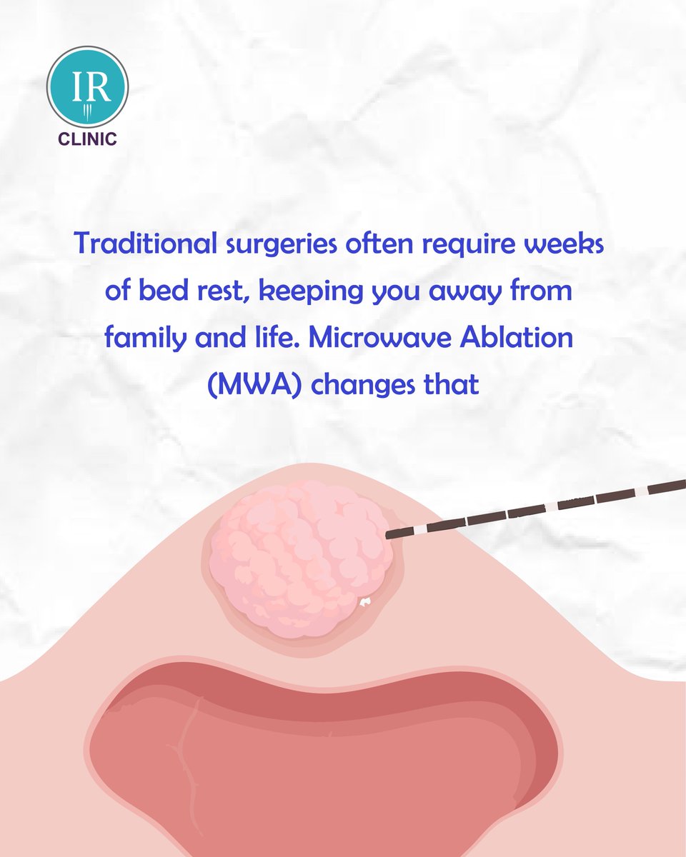 irclinic2018's tweet photo. Traditional surgery may mean weeks of recovery.
Microwave Ablation (MWA) offers a minimally invasive alternative for patients—helping you recover faster and return to your routine sooner.
Contact Us: +919913535351
#InterventionalRadiology #AlternativeToSurgery #MinimallyInvasive https://t.co/1YlZRdq8Wm