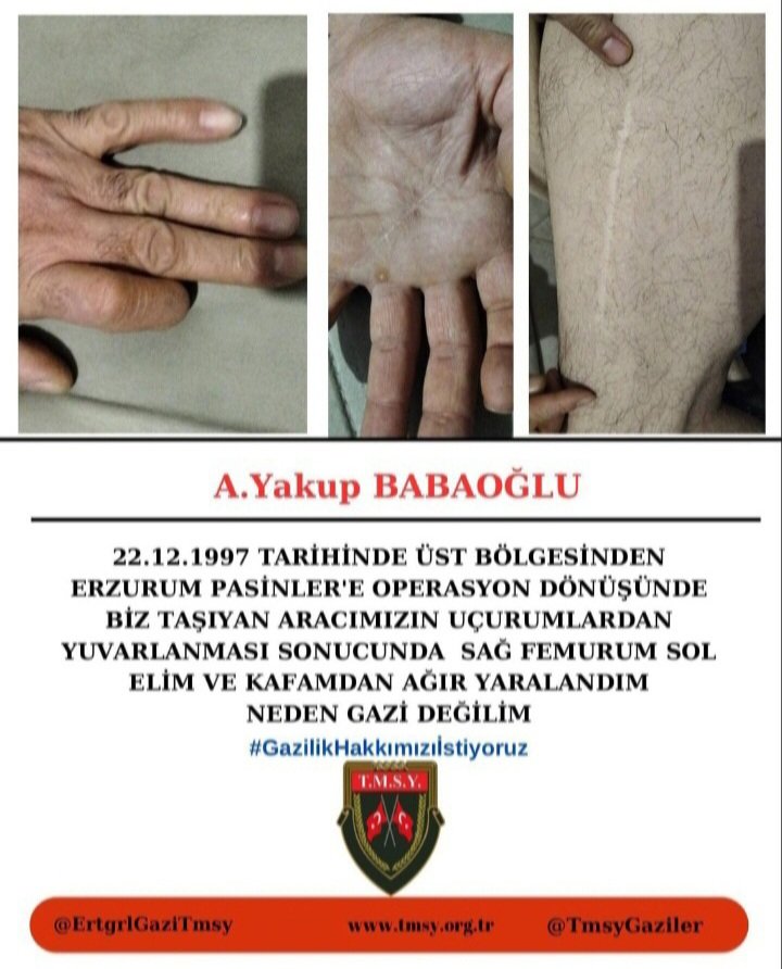 YakupBabaolu1's tweet photo. @VeyselTipioglu @erhansaridede Komisyonda 25 kez toplandınız, her kurumla uzlaştınız! Dosya elinizde hazır beklerken imzaları atmamak kahramanlara haksızlıktır. Oyalama değil, resmî yasa teklifi istiyoruz! 🇹🇷
@TmsyGaziler @hulusiakarmedya @refik_ozen16 @celebimehmeta @tcsavunma @tcailesosyal @FeyziBerdibek1 https://t.co/BxDf67cfHY