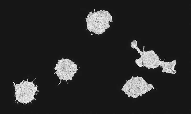 EARA_GR's tweet photo. Dr. Merav Cohen, lead of the study, points that: 
"This research points to a new and promising therapeutic target, one that focuses not only on the cancer cells themselves, but also on the processes that enable them to thrive." #CancerResearch https://t.co/QiL57PPSEy