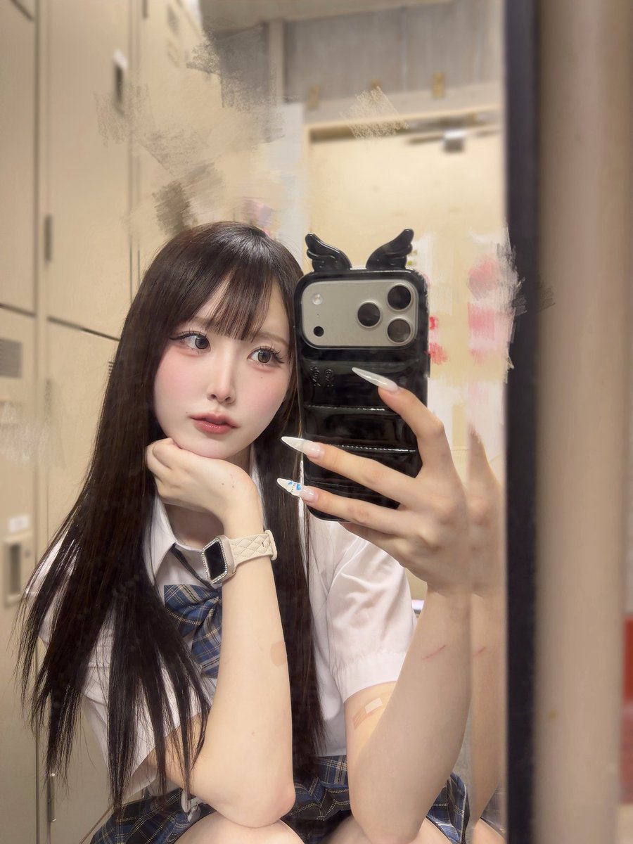 nyac6ta's tweet photo. 愛猫にやられて手と足傷だらけだけど
心と体は超元気だよ^ᴗ ᴗ♡ https://t.co/IkScuIxui5