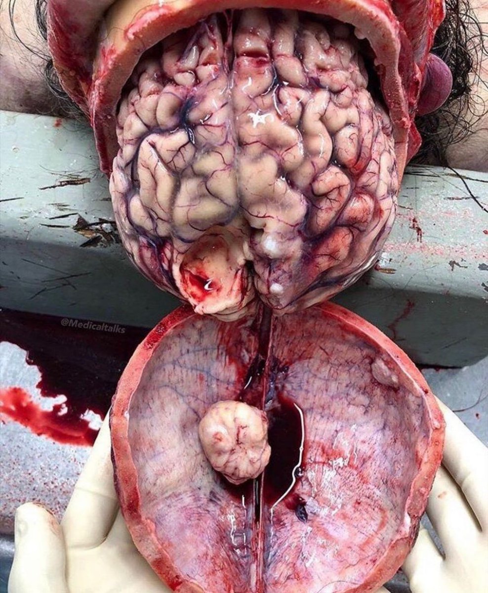 IhabFathiSulima's tweet photo. What is the diagnosis? https://t.co/M0Do417Q1y