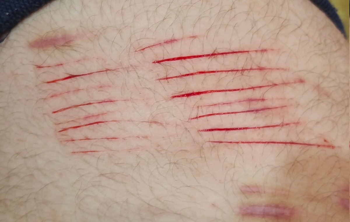 izukucuts's tweet photo. never getting clean again because why the fuck did i go from always doing deep styros and bb beans to cat scratches and bb styros. fake everything sfx makeup #shtwt #styrotwt #slittwt https://t.co/GknhipyIKo