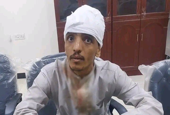 ali1ali212's tweet photo. إصابة المصور محمد سالم بافضل بجروح في الرأس وتدمير كاميرته إثر اعتداء تعرض له من قِبل عناصر المجلس الانتقالي في ساحة العروض بـ #عدن، وسط موجة استنكار تداولها ناشطون ضد استهداف الإعلاميين بتهم التبعية لقناة المهرية.

#أخبار_اليمن https://t.co/jCee99srA4