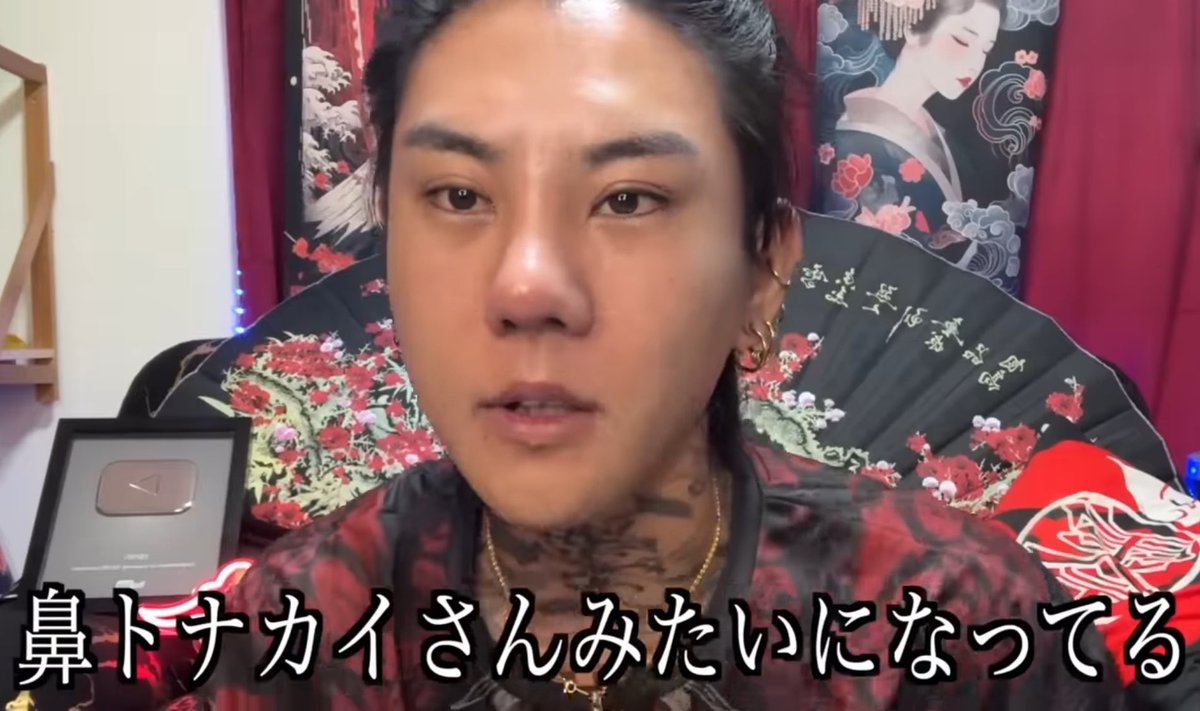motiva55's tweet photo. 【悲報】YouTuberさん、韓国NANA美容外科で鼻整形をするも無惨なお姿になら��る

粗雑なプロテーゼを入れた事で眉間部がアバター化し、鼻尖部軟骨移植では鼻の穴もピンチノーズになり、鼻もタケノコみたいに曲がって生えてしまう。

日本人マーケ病院は🍐だと痛感した事件なのであった。 https://t.co/lOQHwWdHqh