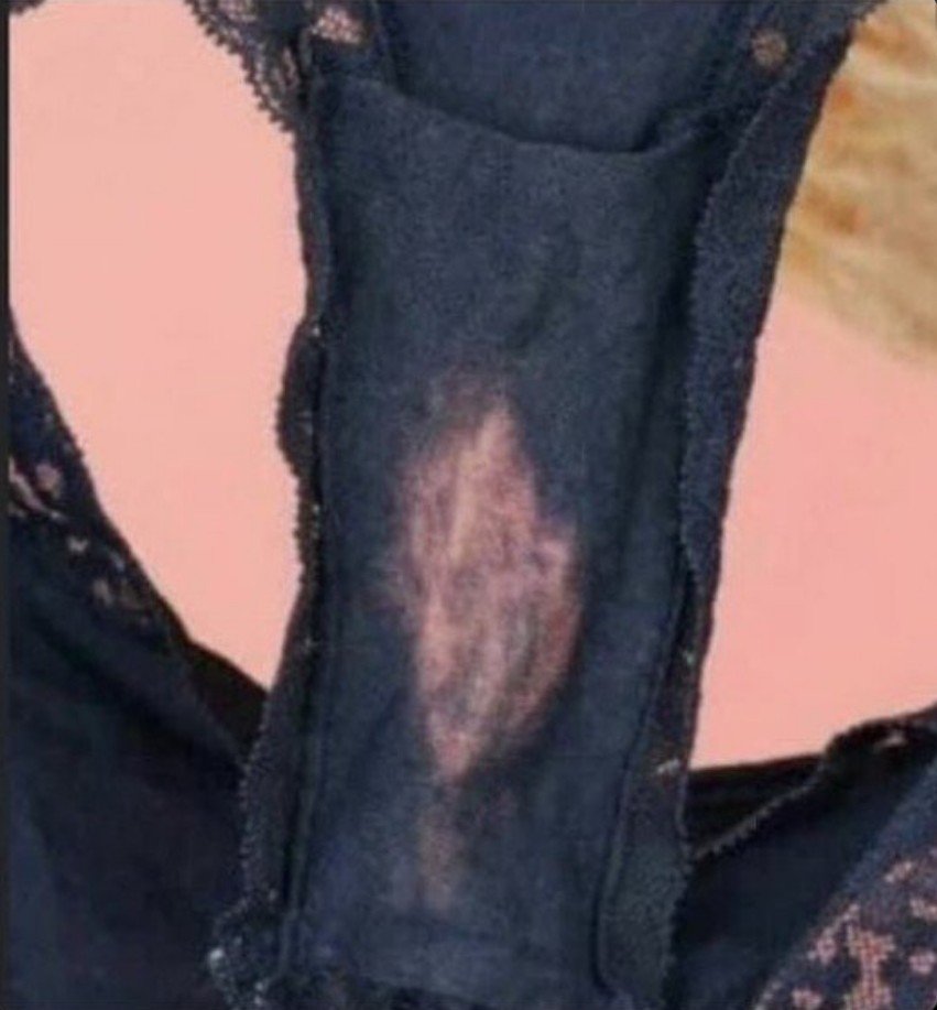 FYP62's tweet photo. Kenapa ya celana dalam perempuan sering muncul bercak putih seperti ini? 🤔 https://t.co/HzJ1alGvNh