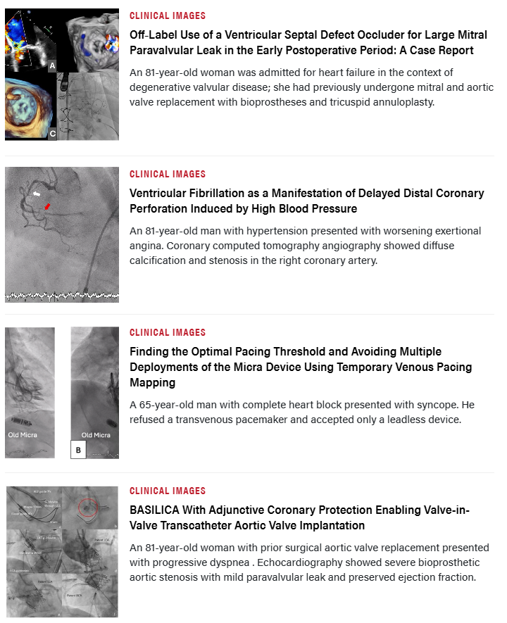 InvasiveCardiol's tweet photo. 📚 The July issue is out now! Read here: https://t.co/mabGR7ip4F

@LUnzue @martinarenaMA @sripalbangalore @esbrilakis @DLBHATTMD #cardioTwitter #cardioX #cardiology #interventionalcardiology https://t.co/R6T8re6nn1