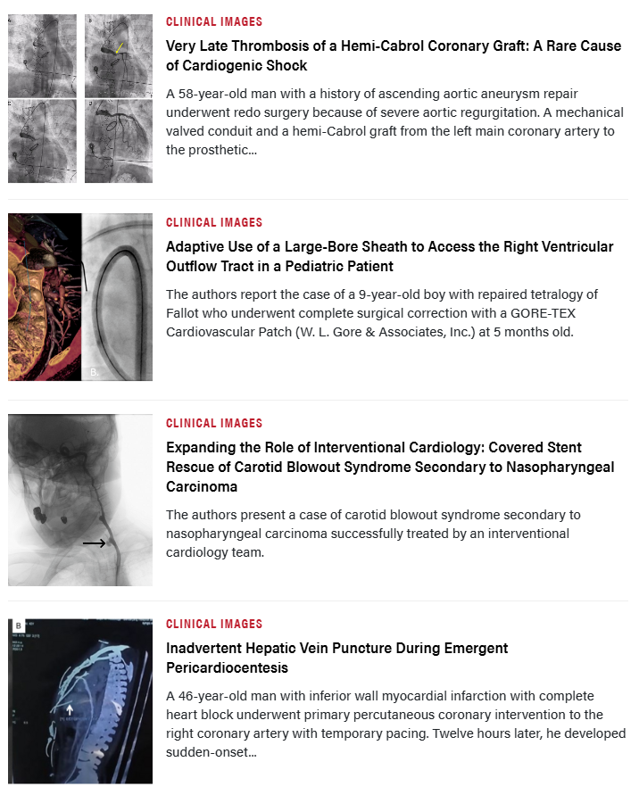 InvasiveCardiol's tweet photo. 📚 The July issue is out now! Read here: https://t.co/mabGR7ip4F

@LUnzue @martinarenaMA @sripalbangalore @esbrilakis @DLBHATTMD #cardioTwitter #cardioX #cardiology #interventionalcardiology https://t.co/R6T8re6nn1