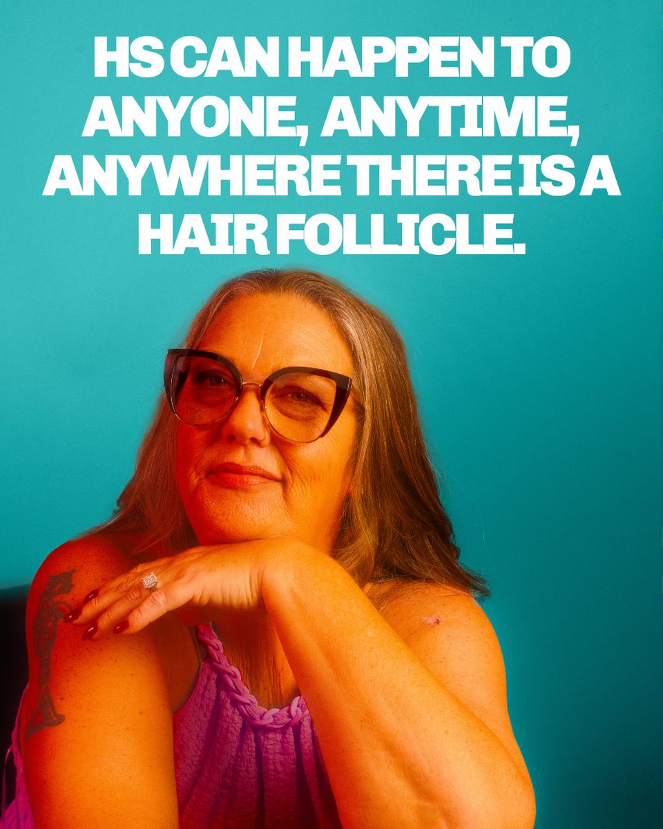 HSConnectOrg's tweet photo. HS is more than skin deep; It affects body, mind, & heart. On World Skin Health Day, remember: you are not alone, it is not your fault, & support exists. To learn more or find a dermatologist, use the link https://t.co/P1xzZKCGQT 💜 #WorldSkinHealthDay #HSAwareness #HSConnect https://t.co/19wJ0Eej5Q