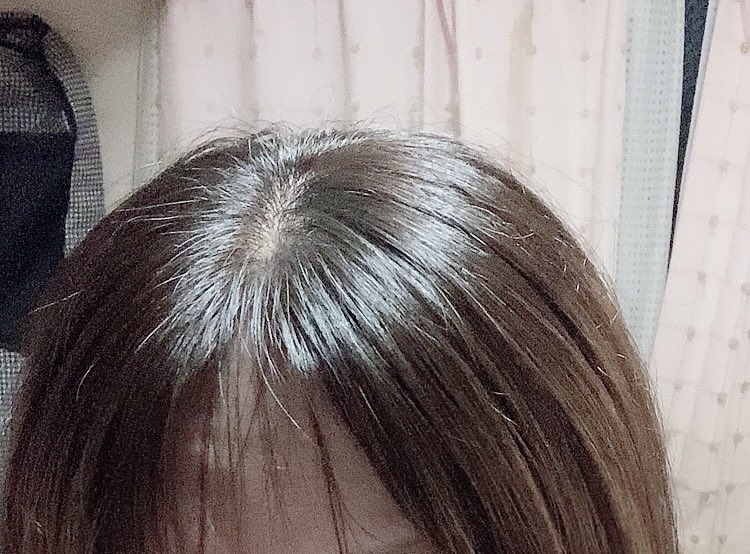 ichippuyu_'s tweet photo. (°ω｡ )？？？

あんま変化はわからんが
白髪は目立たなくなった(°ω｡ ) https://t.co/wIFuDryaKH