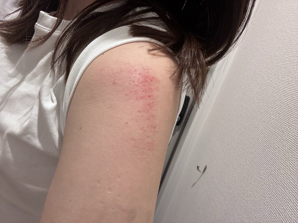 ware_hachiware_'s tweet photo. 仕事の出張先の道路でド派手にこけた。
顔からいかなくてよかった、、
痛すぎる、、😭
そしてホテルの真横に薬局あって良かった。 https://t.co/K2BIQgZvFO