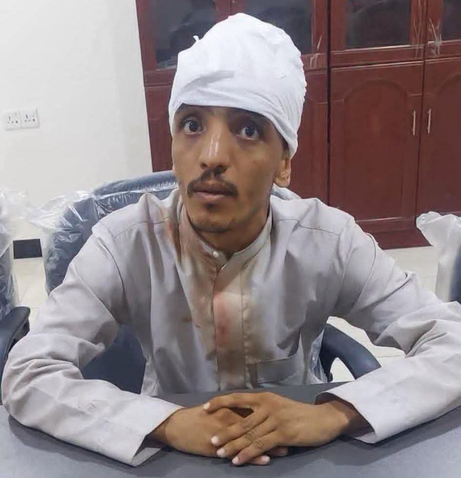 m_albayhani's tweet photo. بافضل احد مهابيل شبوة الذين لا يزالون يؤمنون بهذا المشروع القروي المسمى القنوب.

تحمل عناء المشوار وجاء بكيمترته ليغطي فعالية الانتقالي المنحل والذي هو من مناصريه.

لكن ذلك لم يشفع له عند بلاطجة المثلث لانه من شبوة فكسروا راسه وكيمرته.

نفس ٨٦ عندما كانوا يصفوا ابناء شبوة بالهوية https://t.co/mUbUjfcAmq