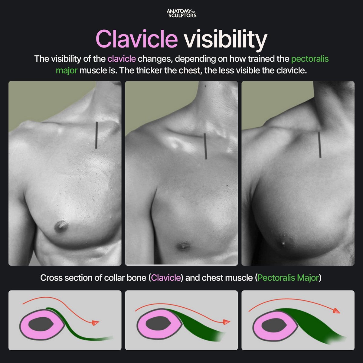 A4Sculptors's tweet photo. Clavicle visibility depends on how developed the pectoralis major muscle is. A thicker chest has more volume over the bone and reduces its visibility, while a leaner chest leaves the clavicle more exposed under the skin. #anatomy #3dmodeling #characterdesign https://t.co/L3toLzWmjd