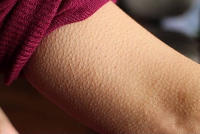 𝐆𝐚𝐥 tweet media