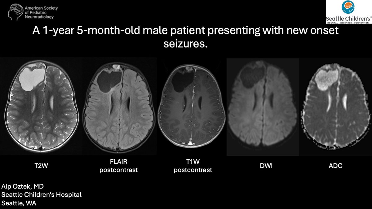 American Society of Pediatric Neuroradiology tweet media