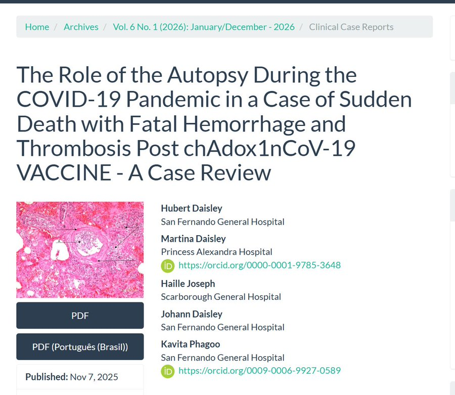 mRNAdeaths's tweet photo. "This case report describes an elderly patient who experienced sudden death from fulminant pulmonary, gastrointestinal and nasal hemorrhage one day after receiving his second dose of the AstraZeneca ChAdox1nCoV-19 vaccine" https://t.co/3E6odtMvrg