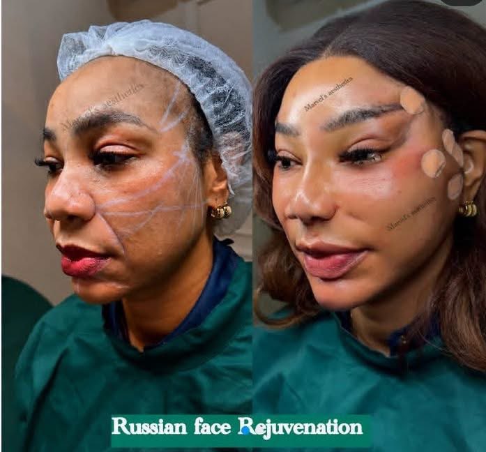 Uche_Gloriaa's tweet photo. Actress Ola Daniels spent 4.5M on a facelift, and people are saying it made her look younger.
What do you think? Did the money pay off, or was it not worth it? 
If you had 4.5M to spend,would you do a facelift too,or use the money for something else? https://t.co/HSEZohZ9rR