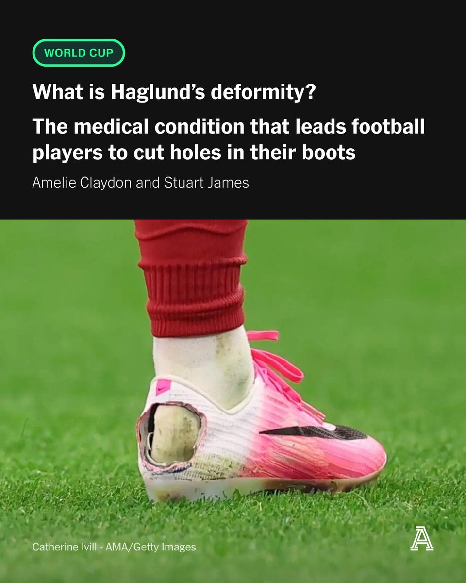 TheAthleticFC's tweet photo. Why do football players at the World Cup cut holes in their boots?

@amelieaclaydon explains one possible reason.

■ What is Haglund's deformity?
■ What causes it?
■ Can it be cured?

While @stujames75 gives a personal experience of how painful it can be.

🔗 https://t.co/qzefGoLeF9