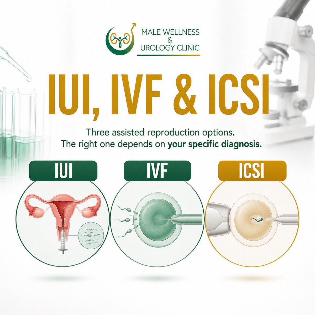 malewellnesske's tweet photo. No sperm in the semen doesn't always mean no sperm at all.
Treatments like TESA can retrieve sperm directly from the testicles, while IVF/ICSI help achieve fertilization-even when only a few sperm are available.
One diagnosis. Multiple paths to fatherhood. #MaleFertility #TESA https://t.co/yjxu9Uar8U